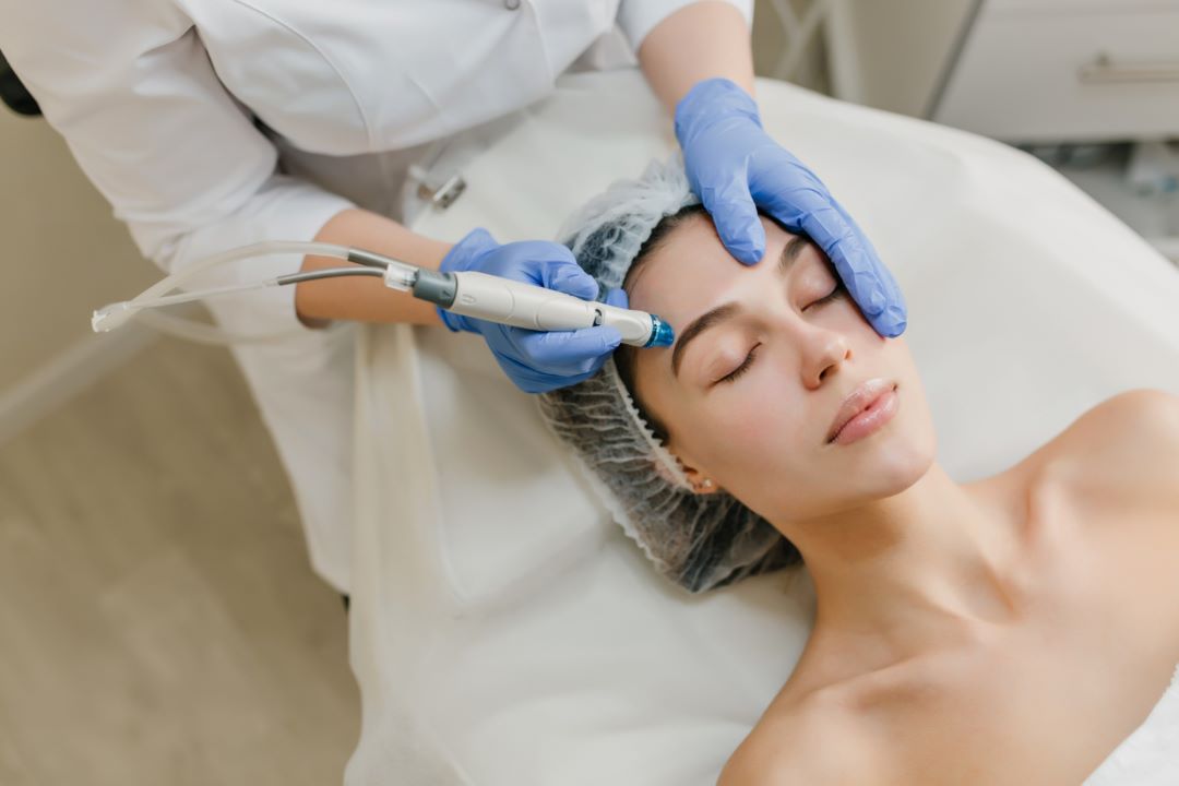 Microneedling in Tarrytown