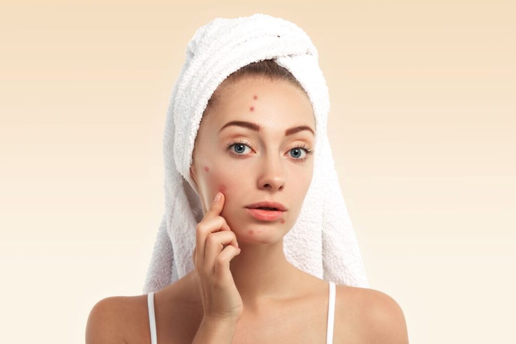 Korean acne treatments